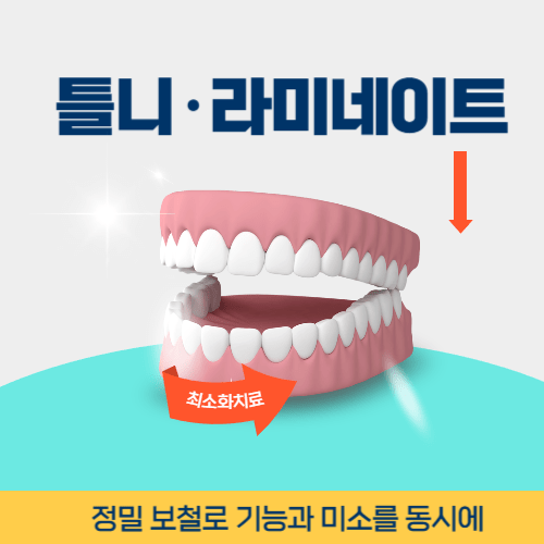 순천치과 순천시 치과 틀니 라미네이트