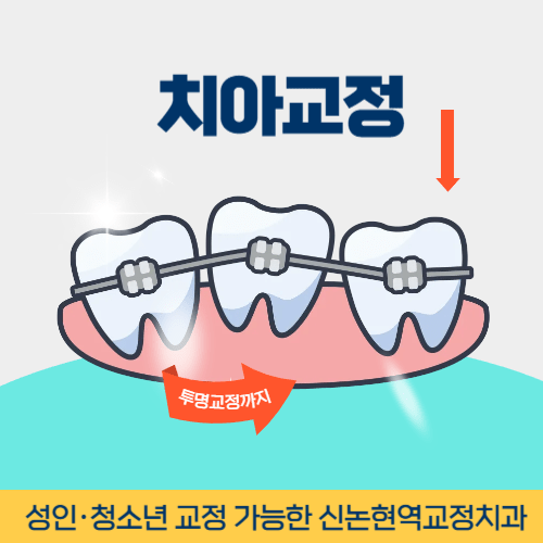 순천치과 순천시 치과 치아교정