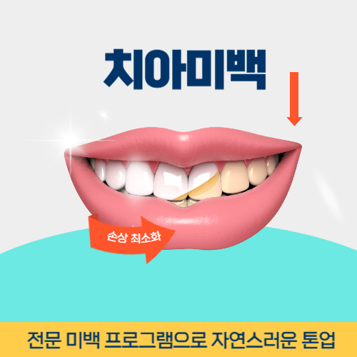 순천치과 순천시 치과 치아미백