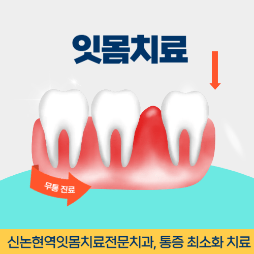 순천치과 순천시 치과 잇몸치료